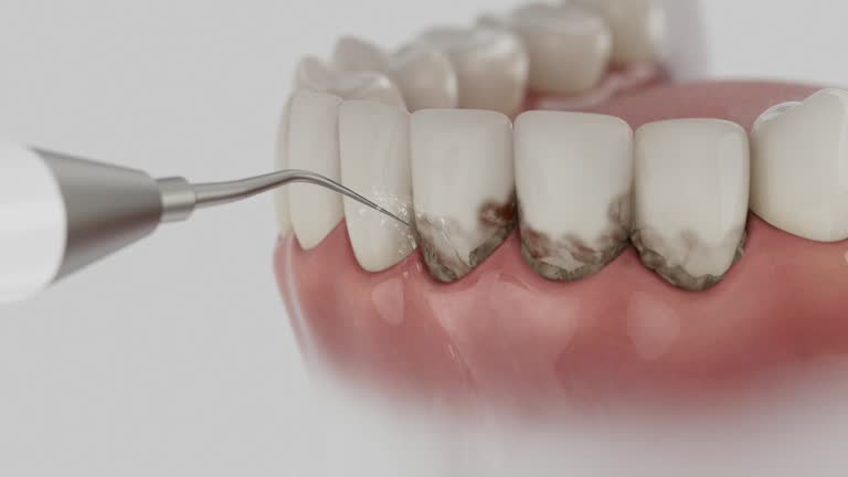 Trusted Tooth Extraction service in Parsons, TN - Dentist Open Now
